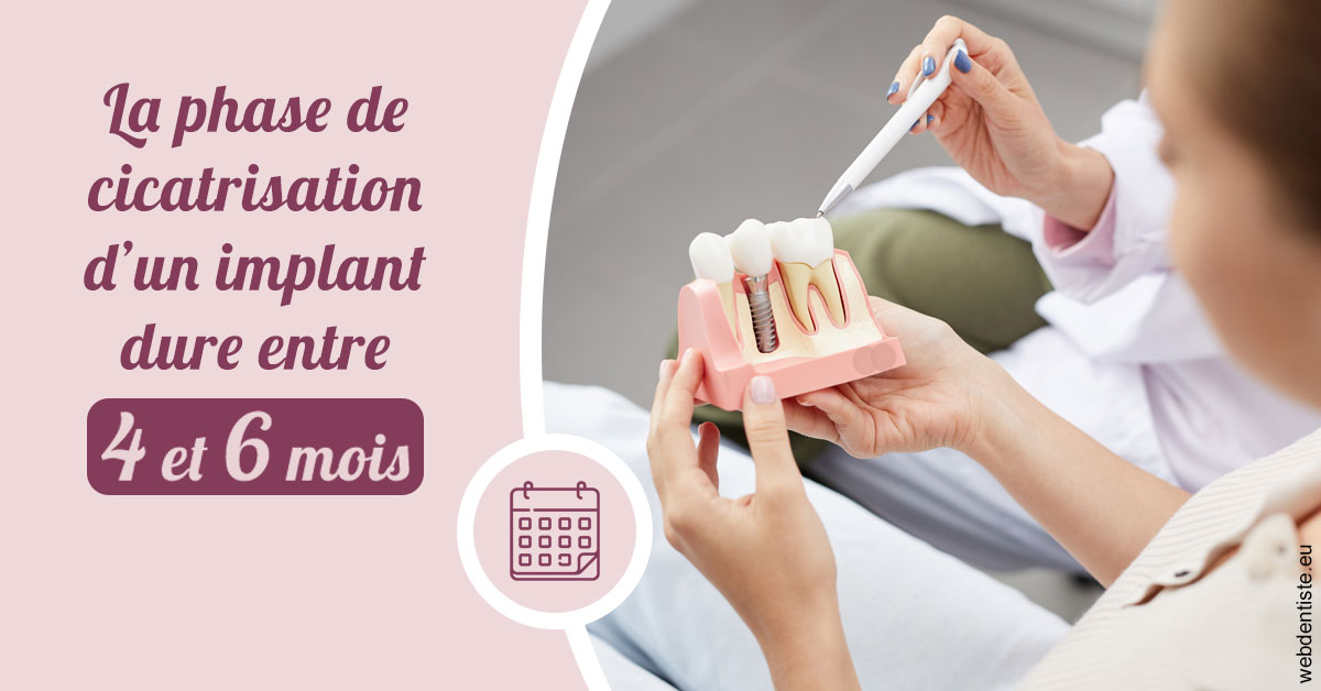 https://selarl-dr-fauquet-roure-coralie.chirurgiens-dentistes.fr/Cicatrisation implant 2