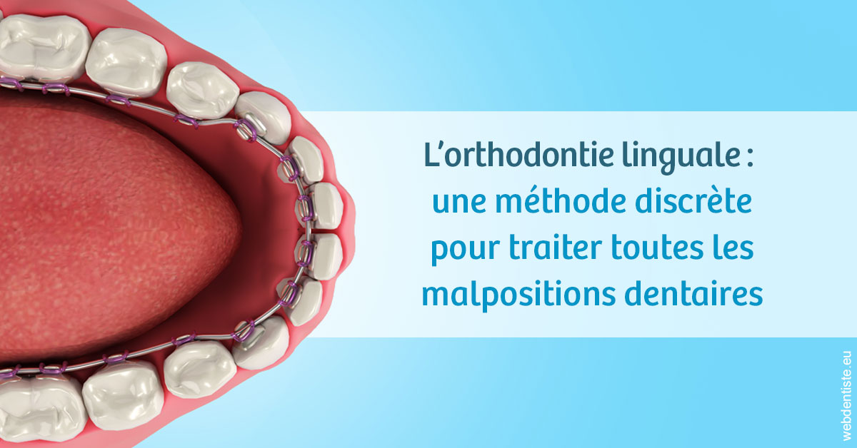 https://selarl-dr-fauquet-roure-coralie.chirurgiens-dentistes.fr/L'orthodontie linguale 1