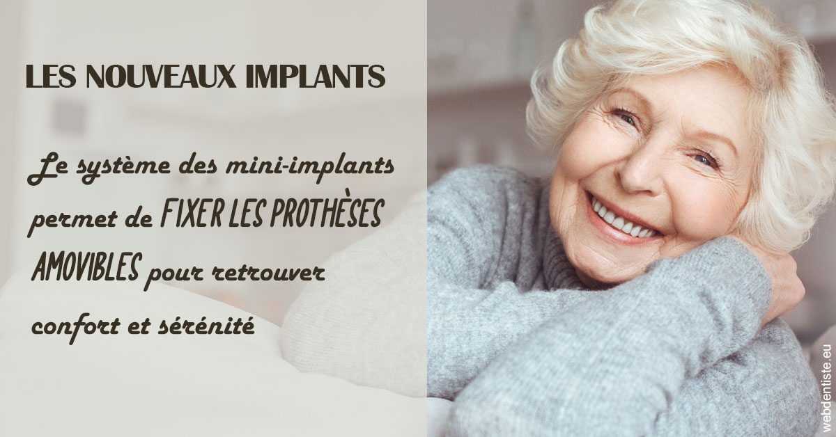 https://selarl-dr-fauquet-roure-coralie.chirurgiens-dentistes.fr/Les nouveaux implants 1