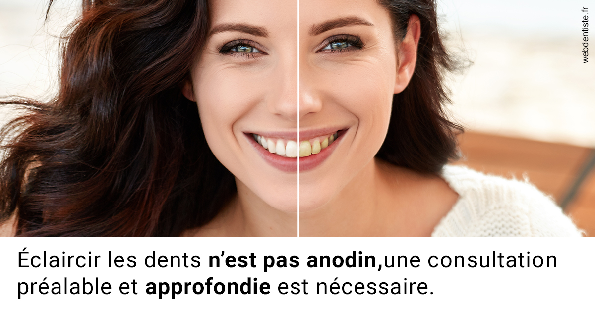 https://selarl-dr-fauquet-roure-coralie.chirurgiens-dentistes.fr/Le blanchiment 2