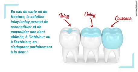 https://selarl-dr-fauquet-roure-coralie.chirurgiens-dentistes.fr/L'INLAY ou l'ONLAY