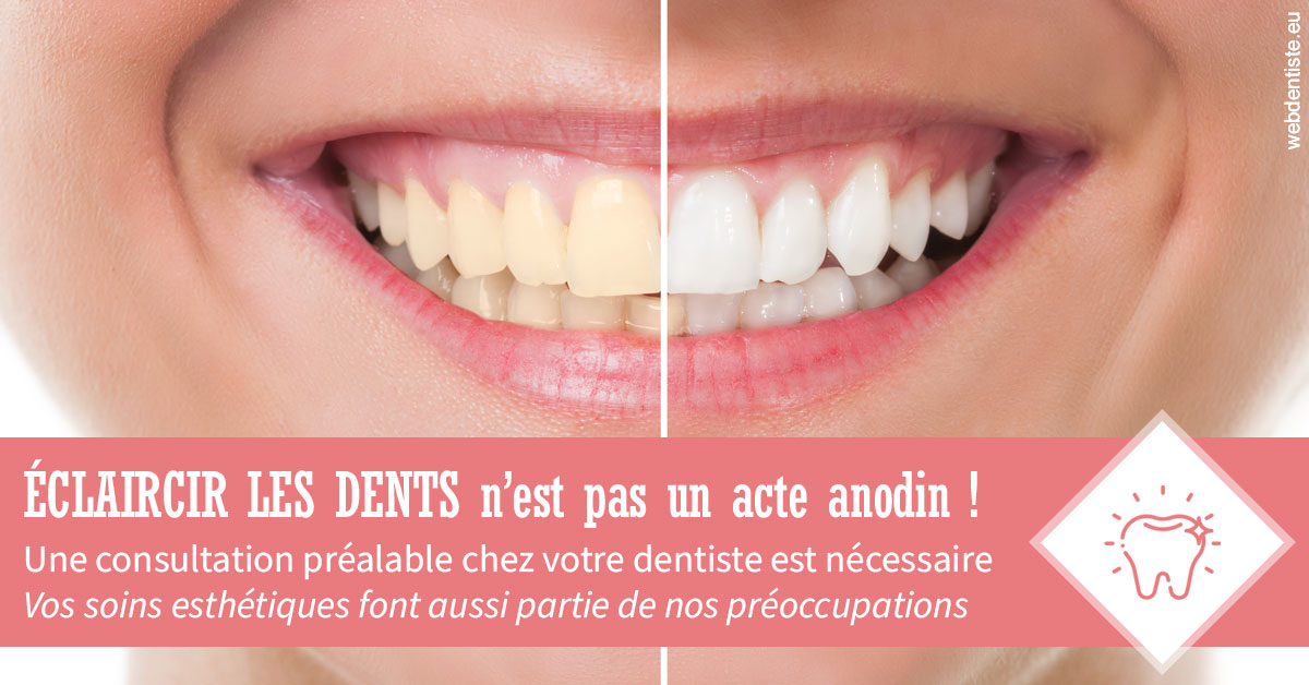 https://selarl-dr-fauquet-roure-coralie.chirurgiens-dentistes.fr/Eclaircir les dents 1