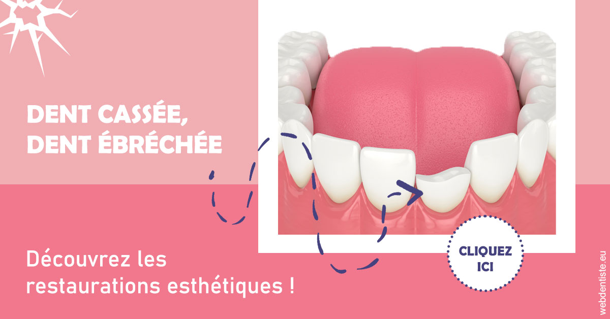 https://selarl-dr-fauquet-roure-coralie.chirurgiens-dentistes.fr/Dent cassée ébréchée 1