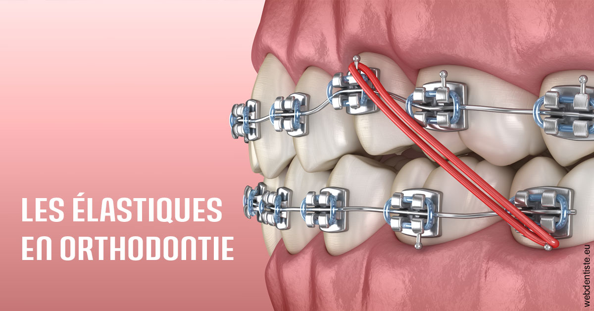 https://selarl-dr-fauquet-roure-coralie.chirurgiens-dentistes.fr/Elastiques orthodontie 2