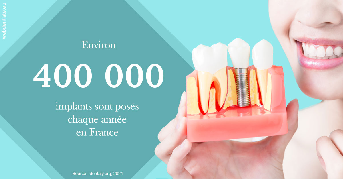 https://selarl-dr-fauquet-roure-coralie.chirurgiens-dentistes.fr/Pose d'implants en France 2